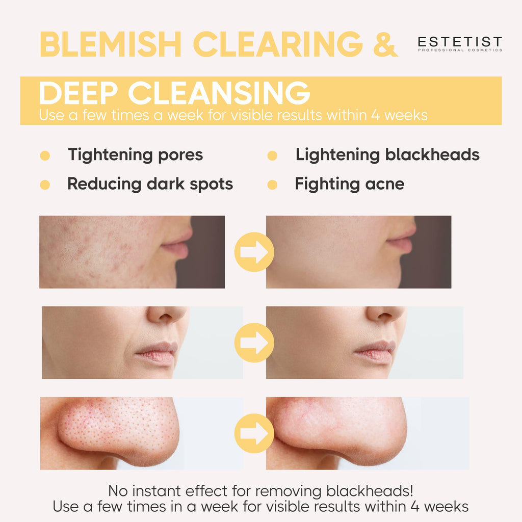 ESTETIST Turmeric Vitamin C Clay Mask Stick – Deep Cleanse, Oil Control, 3-Pack Gift Set