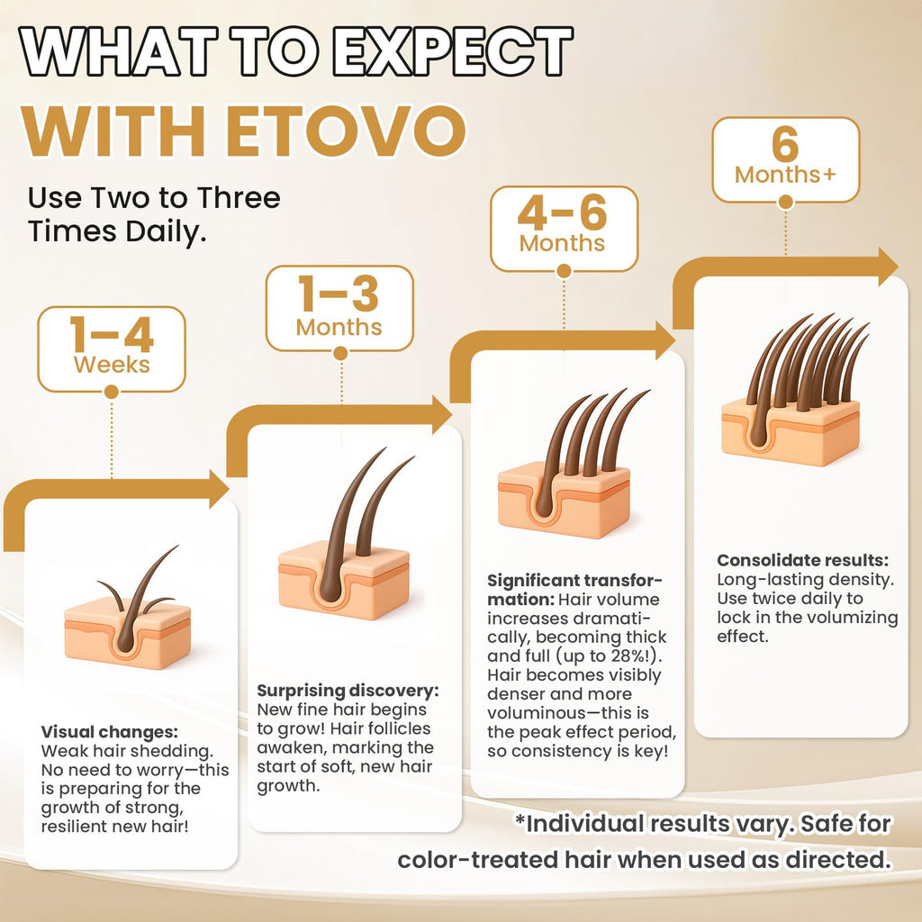 ETOVO 5% Minoxidil for Women – Hair Growth Serum for Thicker, Fuller Hair