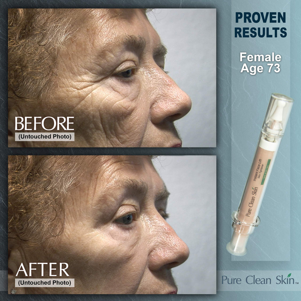 EUZEN Skin Tightening Cream For Face – Instant Lift In 3–5 Minutes
