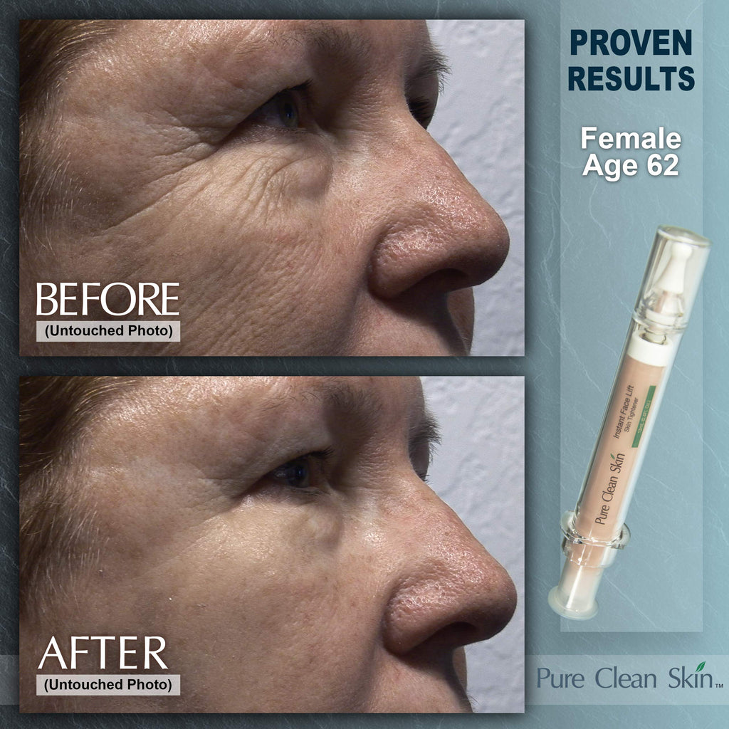 EUZEN Skin Tightening Cream For Face – Instant Lift In 3–5 Minutes