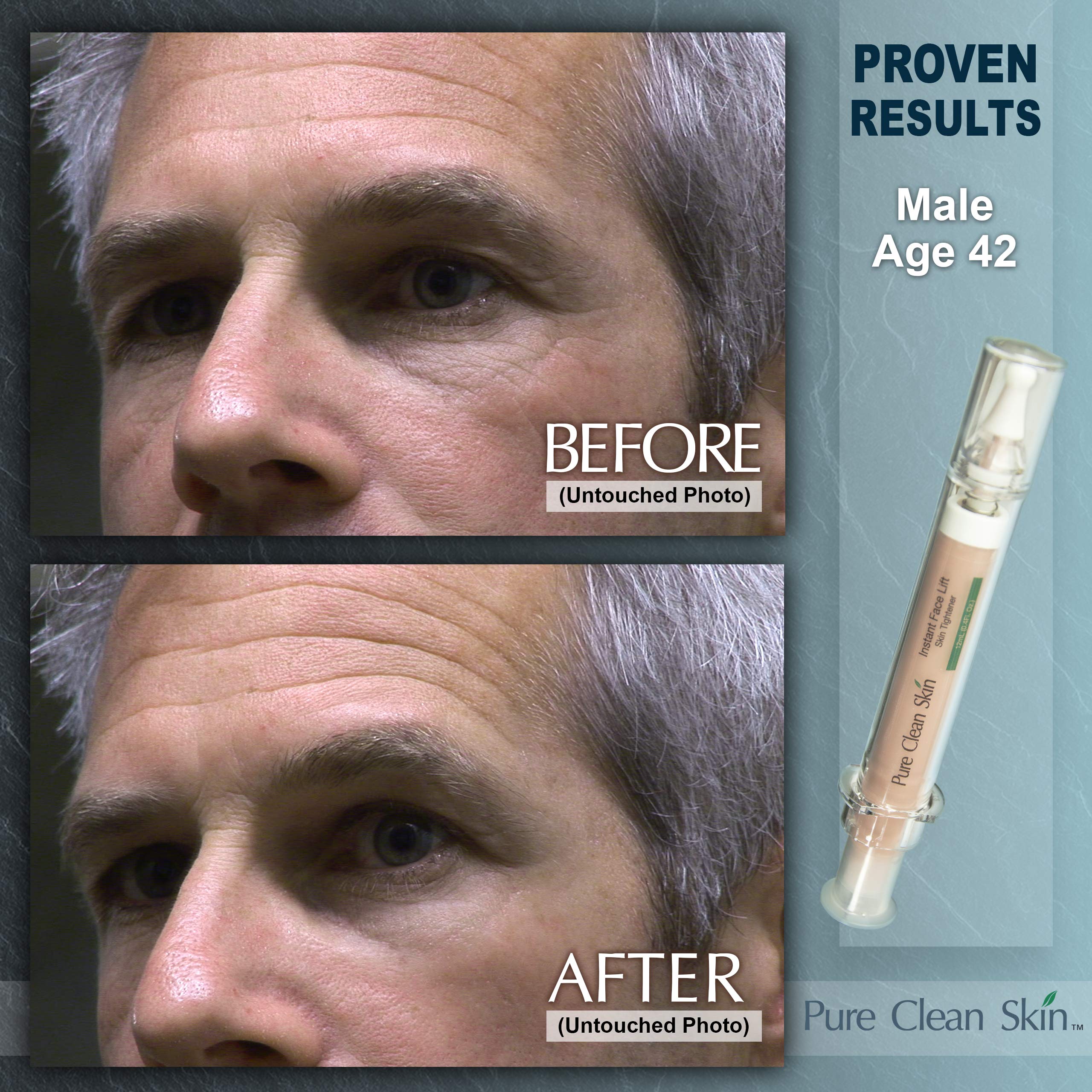 EUZEN Skin Tightening Cream For Face – Instant Lift In 3–5 Minutes