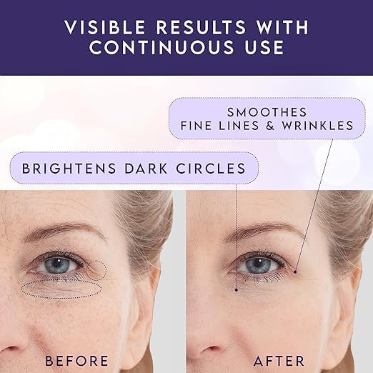 Evdayam Eye Cream with Caffeine – 2-Pack Under-Eye Brightener Stick for Dark Circles & Puffiness