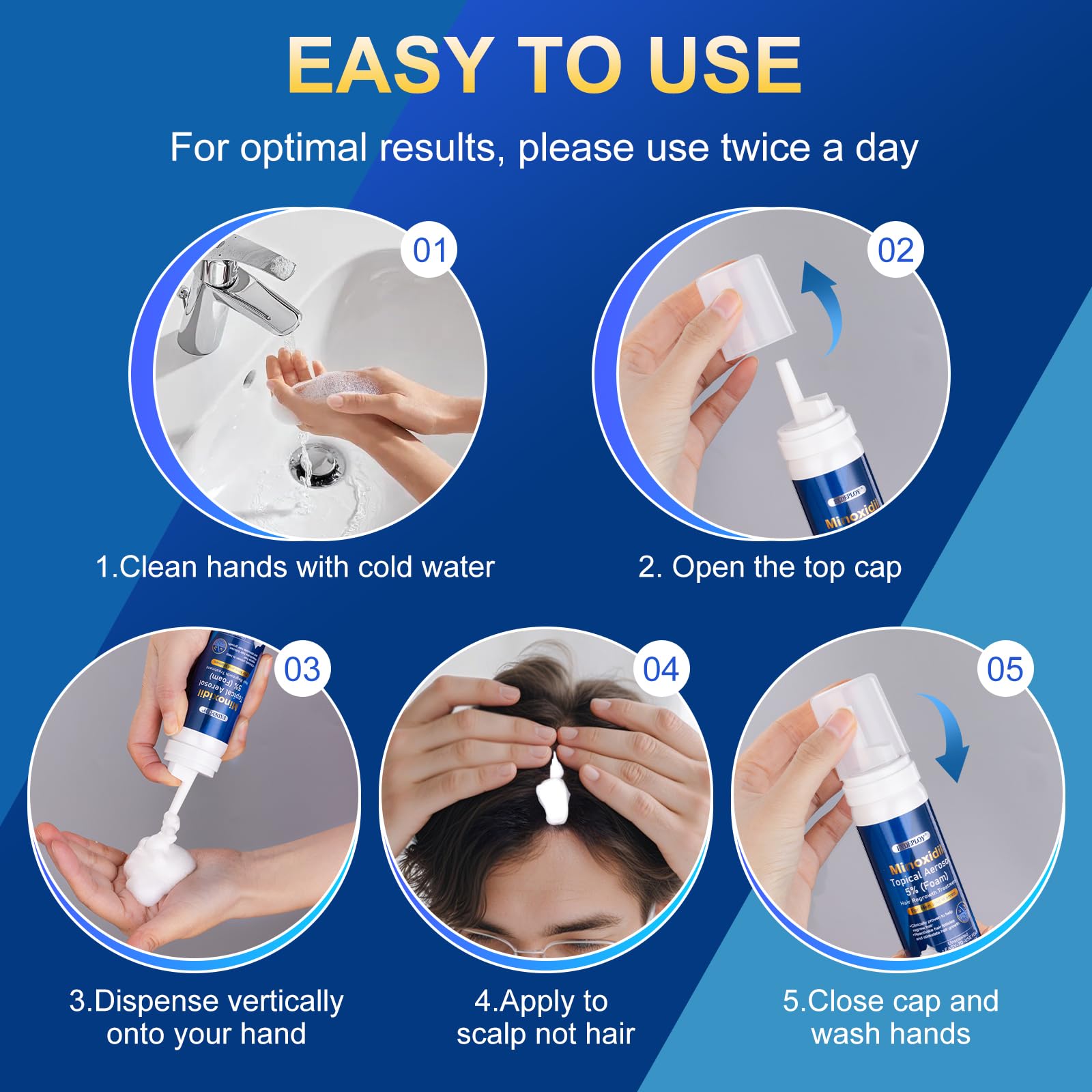 Exdeploy 5% Minoxidil Foam for Men – 5-Pack with Biotin (10.5 oz total)