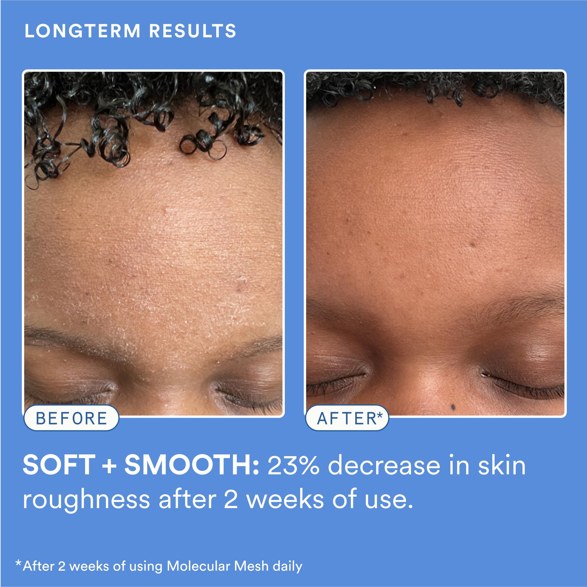 Experiment Molecular Mesh Barrier Repair Face Moisturizer – Lightweight, Soothing Barrier Care for Sensitive Skin