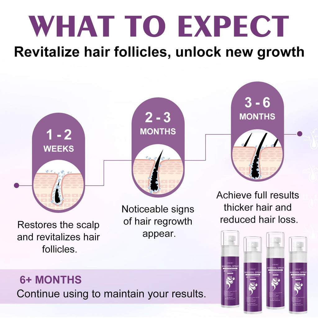 EZBIORT 5% Minoxidil Spray for Women – 4‑Pack, Biotin-Infused Hair Regrowth, 13oz (7 Month Supply)