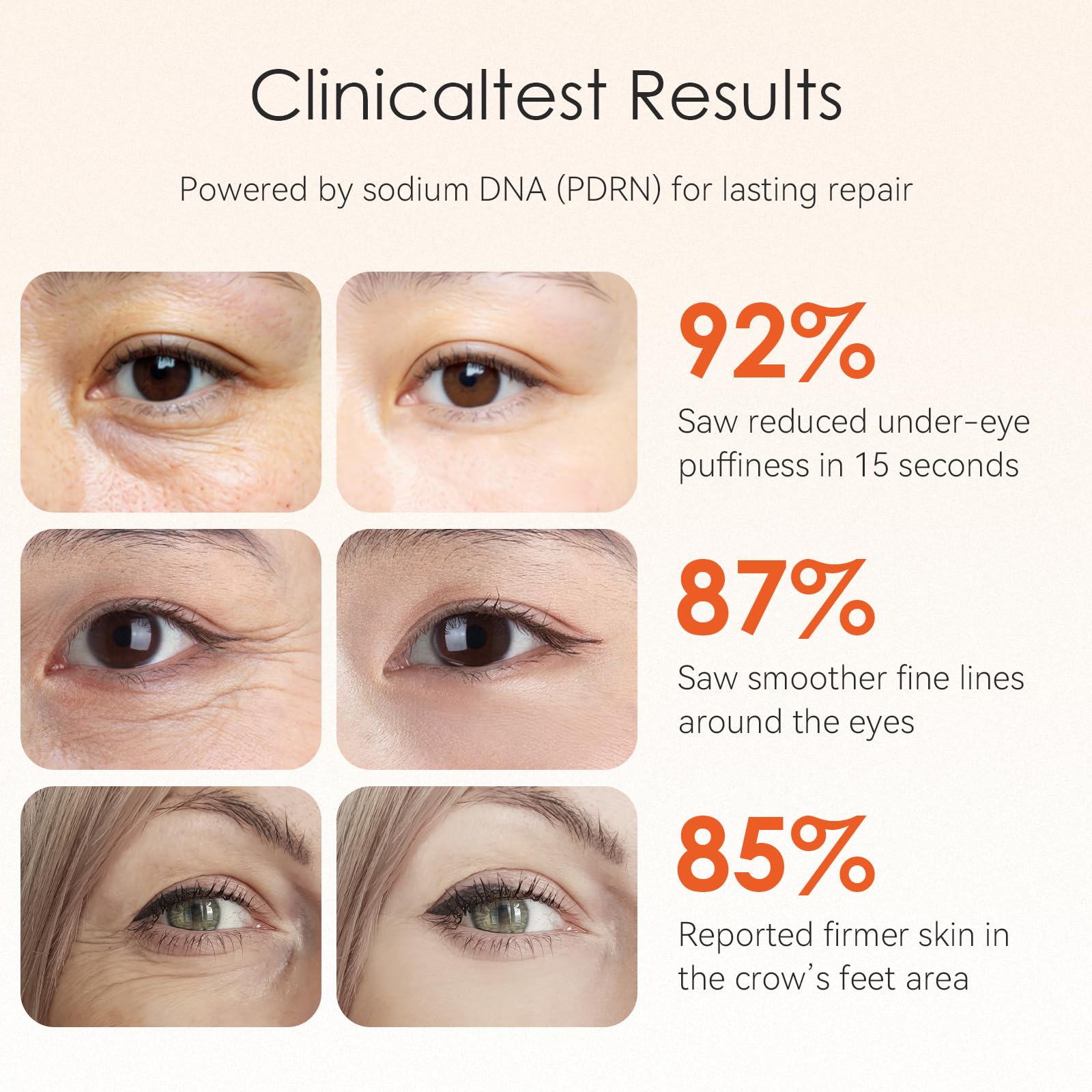 Fankr 15-Second Eye Lift Cream | Sodium DNA, 0.1% Retinal, Caffeine & Peptides