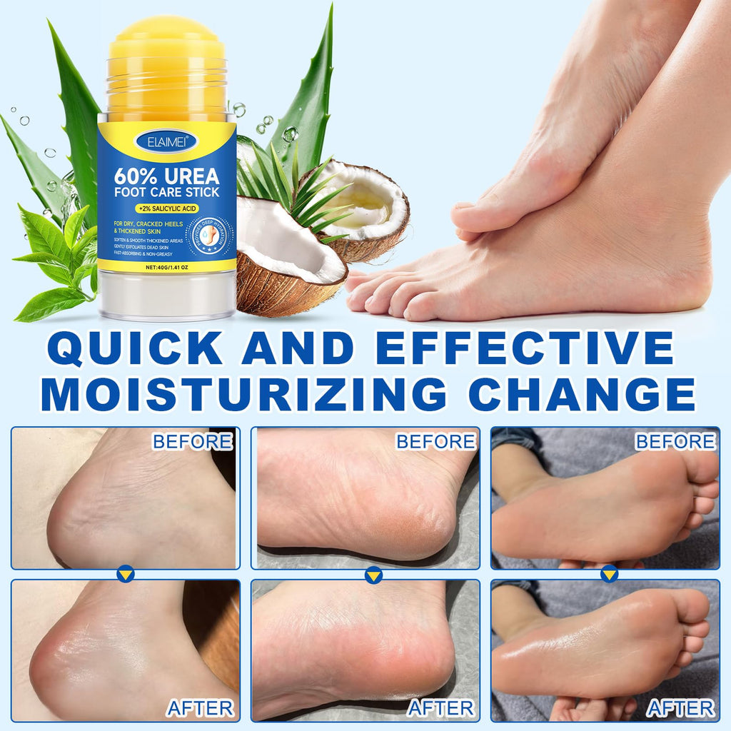 FANSHI 60% Urea Cream Stick – 2-Pack Deep Moisturizing Foot Care for Dry, Cracked Heels