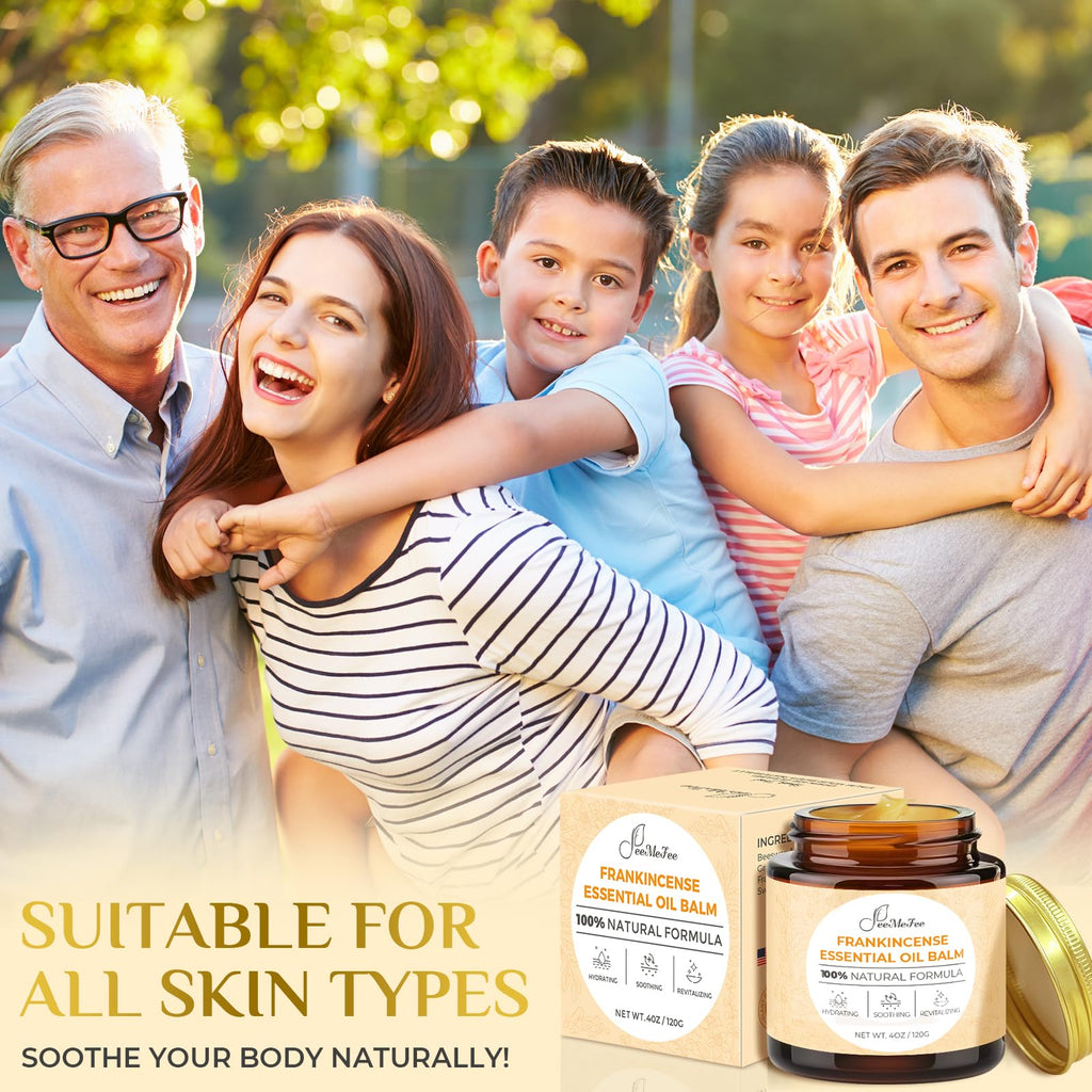 FeeMeFee Frankincense Balm 4oz – Soothing Skin Moisturizer with Myrrh, Boswellia Serrata & Olive Oil