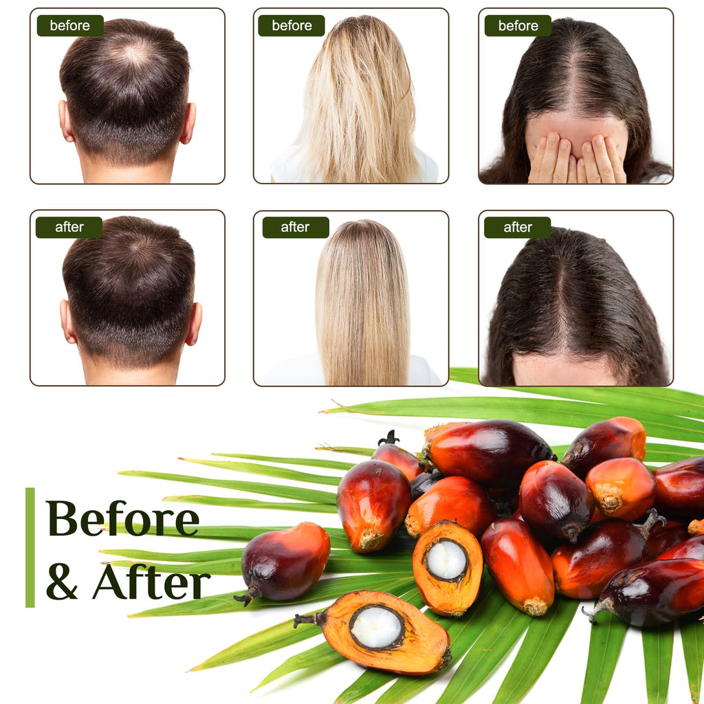 FEIBTH Raw Batana Oil for Hair Growth – Organic Batana Oil, Scalp Nourishment, Thicker Hair