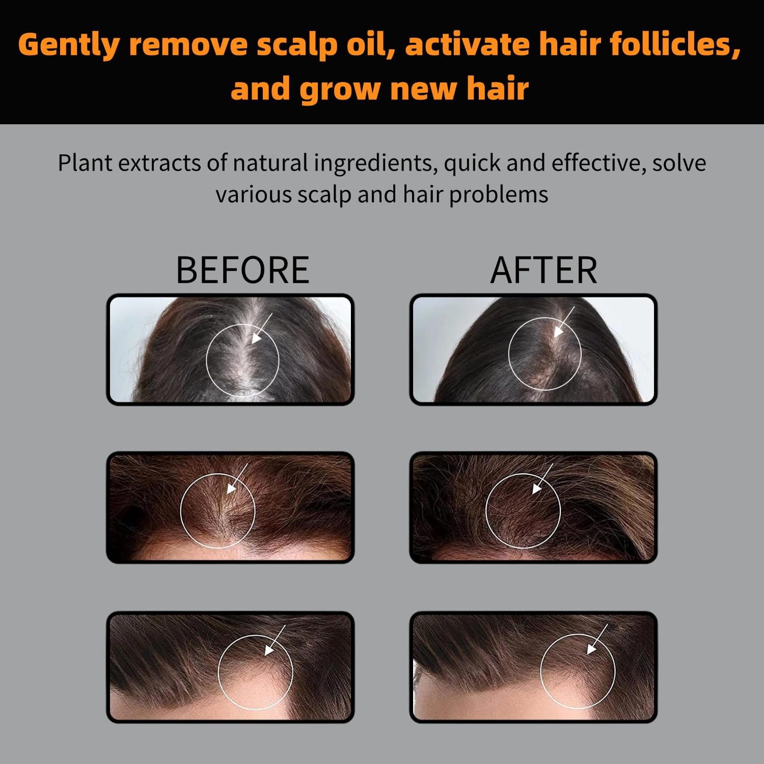 FHH Root Activator Shampoo for Thinning Hair – Strengthen, Nourish, and Add Volume (2-Pack)