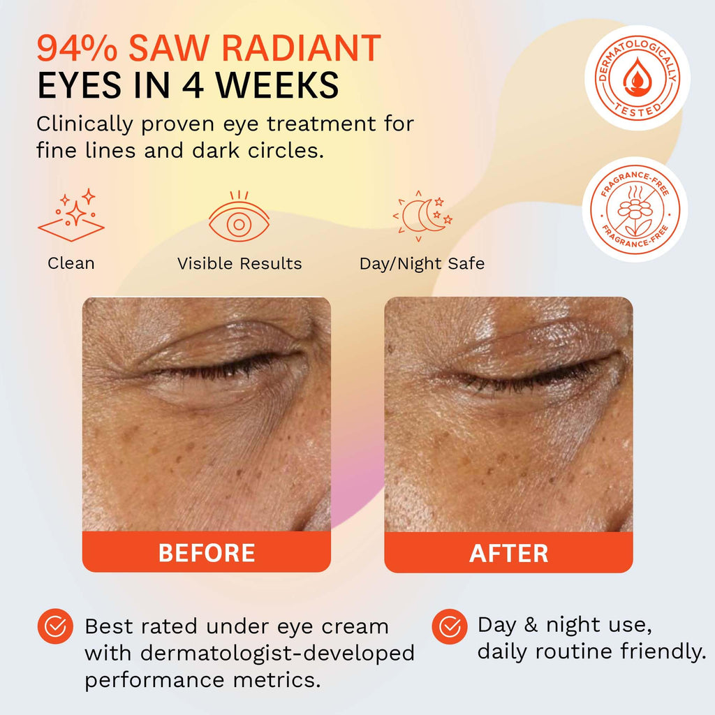 Fig.1 Vitamin C Eye Cream for Dark Circles — Anti-Aging Under Eye Moisturizer