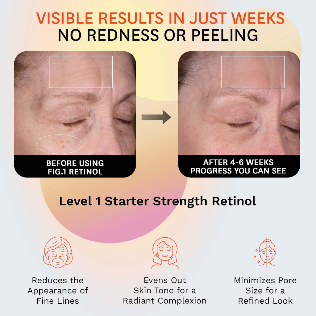 Fig.1 Retinol Night Cream | Hydrating Night Moisturizer with Squalane for Sensitive Skin | Dermatologist Tested