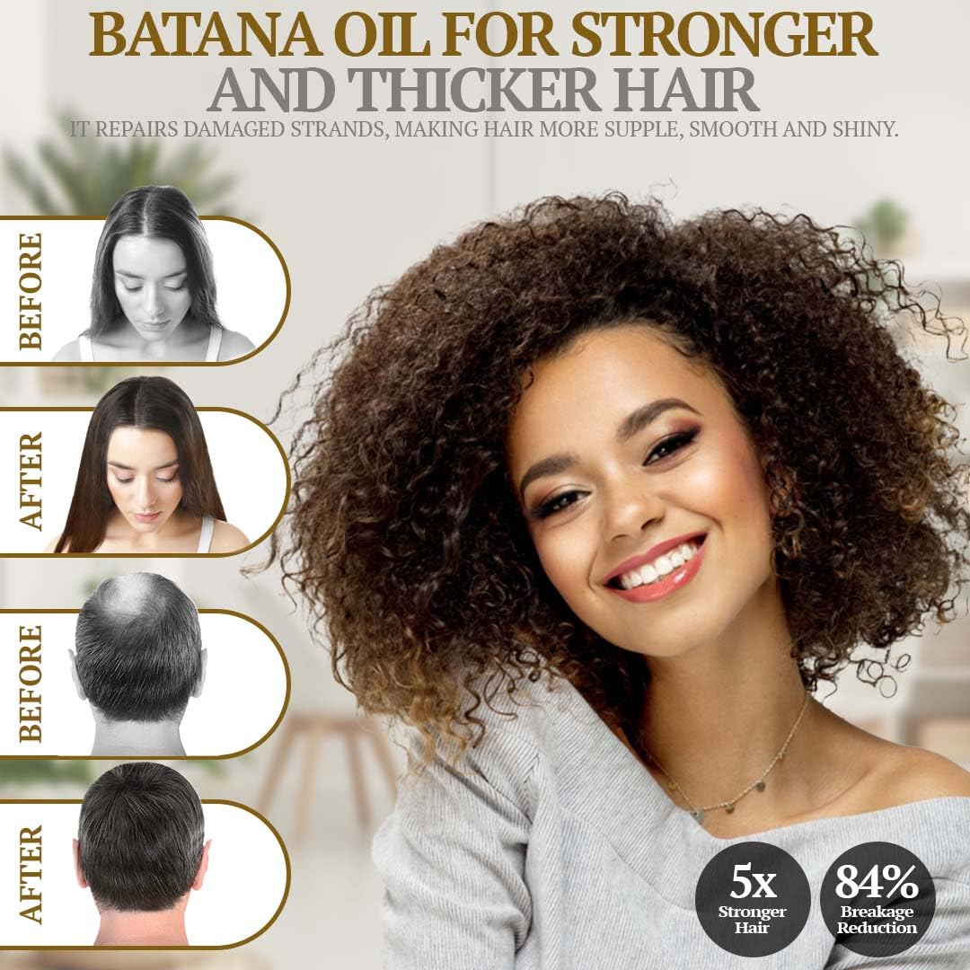 Fiora Naturals Batana Rosemary Oil – Organic Dr Sebi Hair Growth Oil for Thickening, Deep Conditioning & Scalp Stimulation, 4 oz