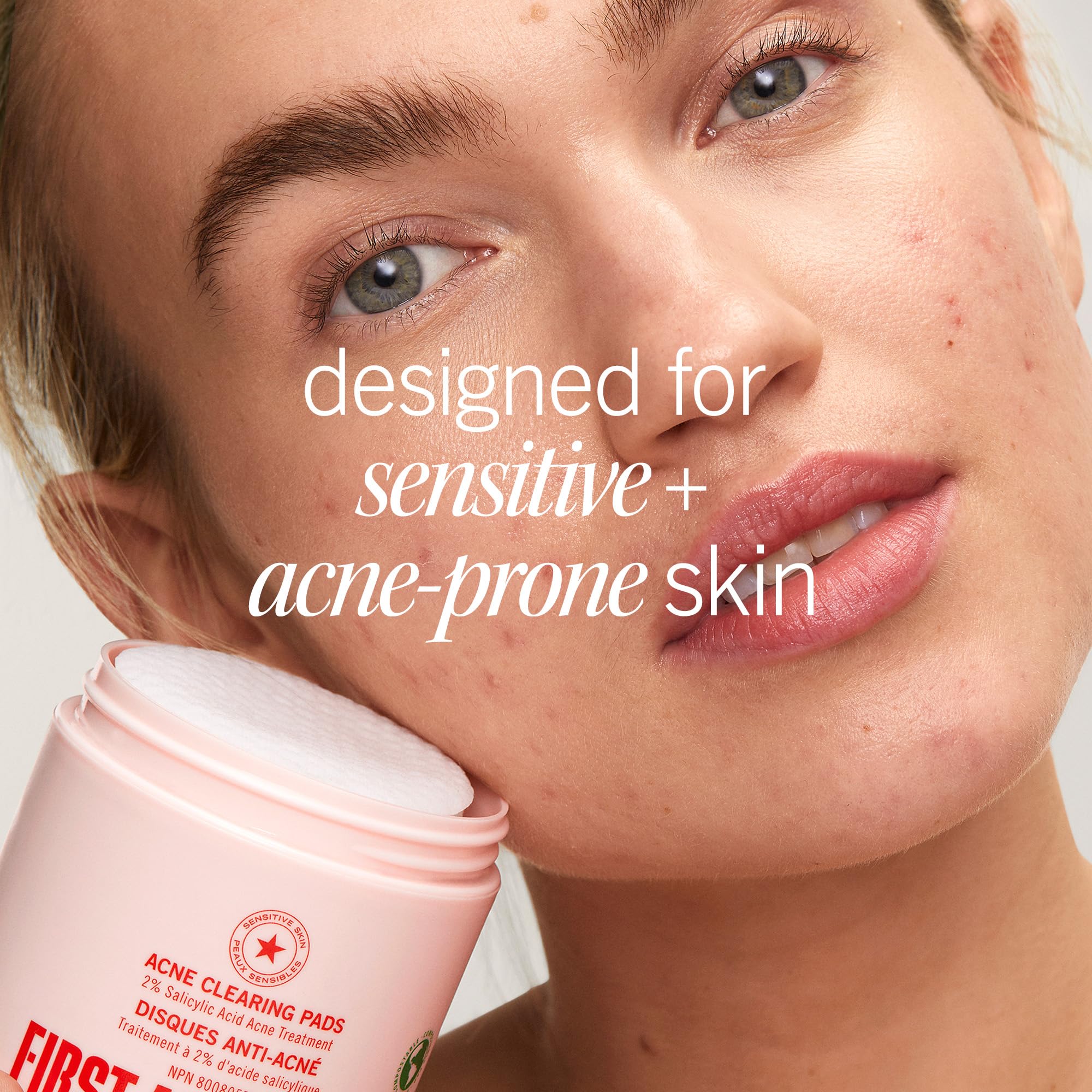 First Aid Beauty Acne Pads – 2% Salicylic Acid, Maximum Strength (60-ct)