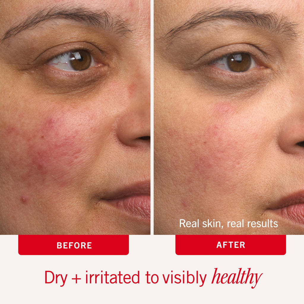 First Aid Beauty Ultra Repair Cream – Intense Hydration for Face & Body, Barrier Support in 7 Days (6 oz)