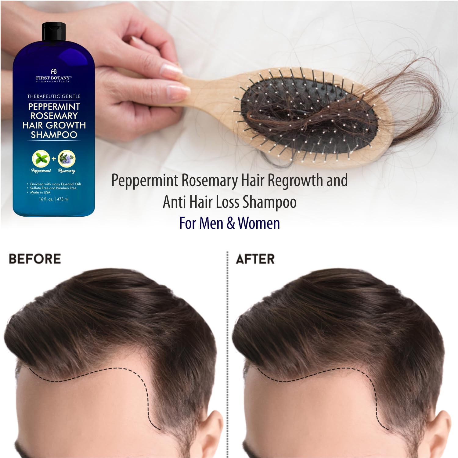 First Botany Peppermint Rosemary Hair Regrowth Shampoo – Anti Hair Loss, Daily Hydration, Detoxifying, Dandruff Control (Pack of 2, 16 oz each)
