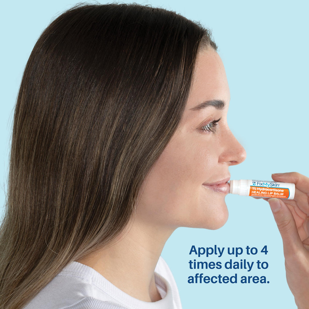 FixMySkin 1% Hydrocortisone Healing Lip Balm – Vanilla | Dermatologist-Developed & Travel-Friendly
