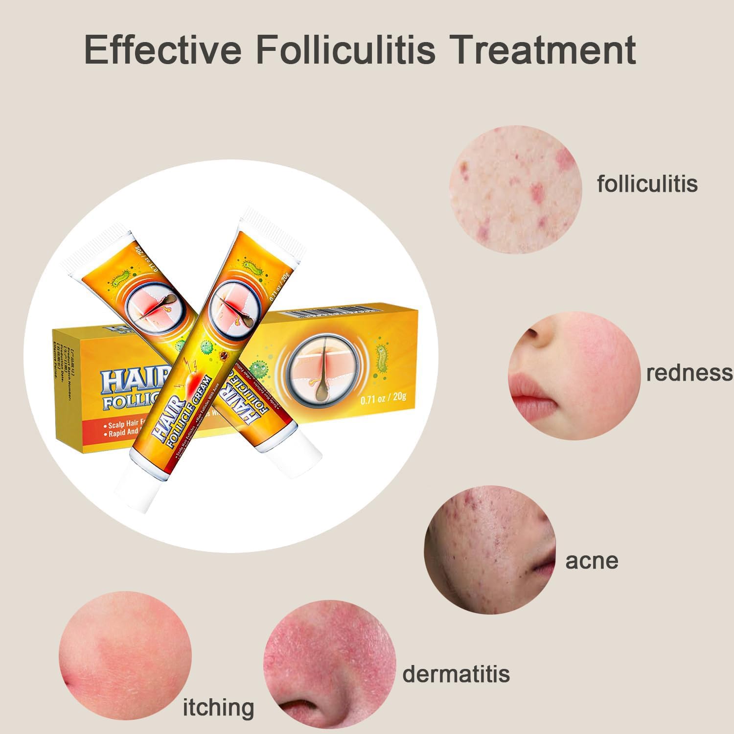 Folliculitis Cream – Effective Folliculitis Treatment for Scalp, Face & Body | 1.42 Oz