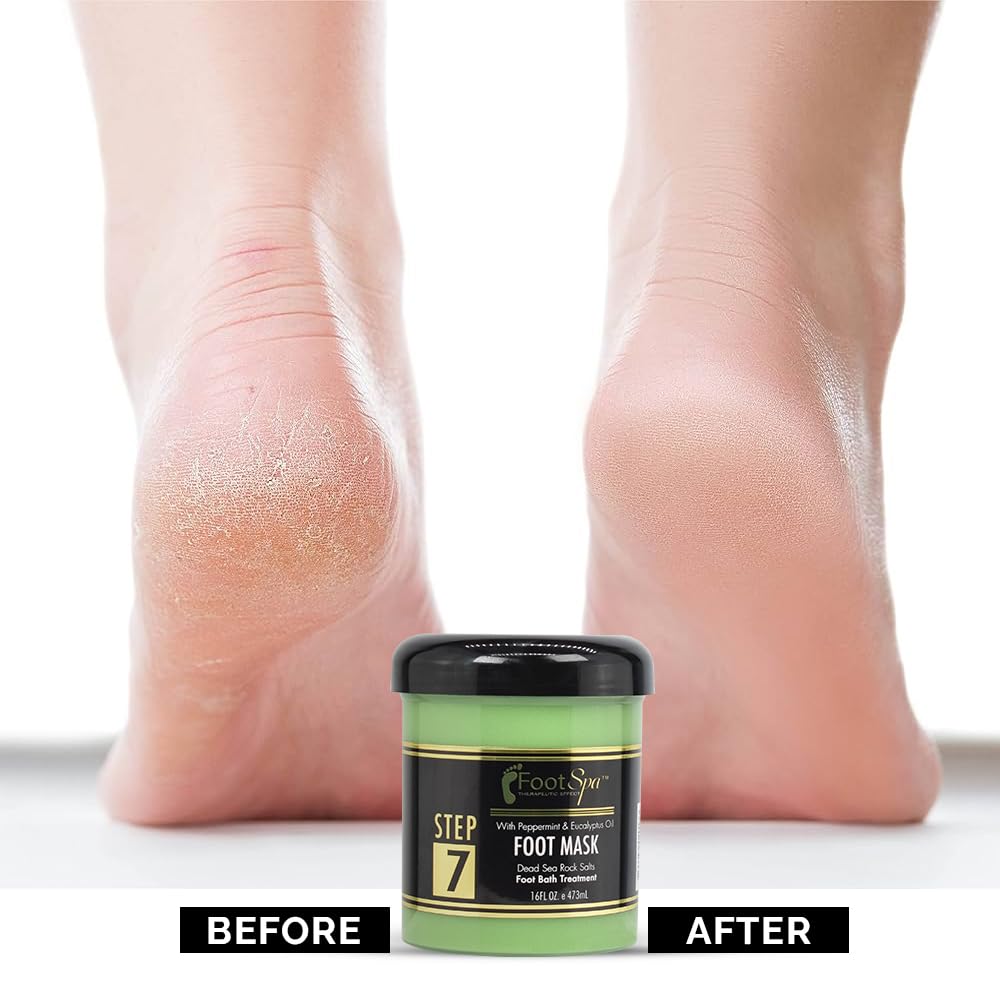 FootSpa Cream Mask for Feet – 16 oz Hydrating Treatment with Peppermint & Eucalyptus, Hyaluronic Acid & Amino Acids