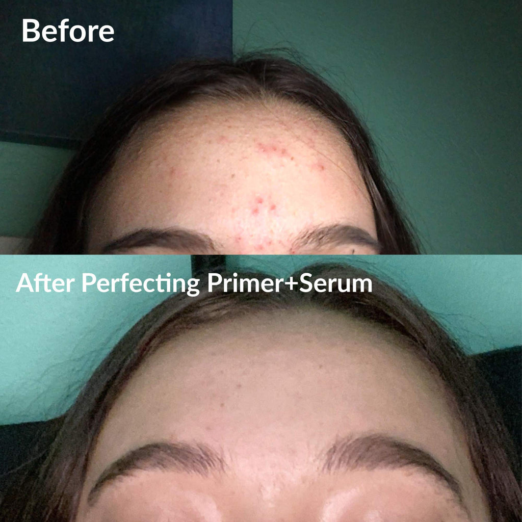 Frilliance 2 in 1 Clear Skin Primer & Serum for Acne | Mandelic Acid, Niacinamide, Vegan & Cruelty-Free