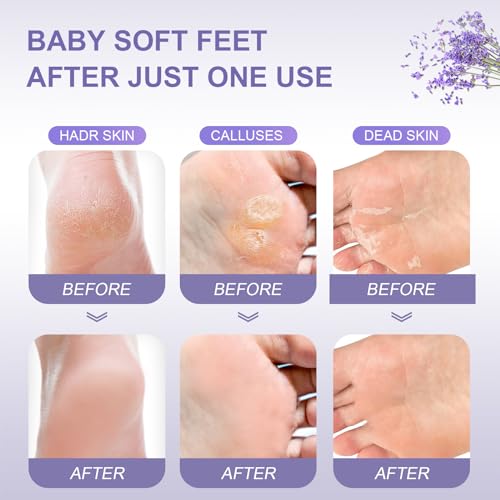FUNNIR Foot Peeling Mask (5 Pack) – Exfoliating Foot Care for Soft, Smooth Feet