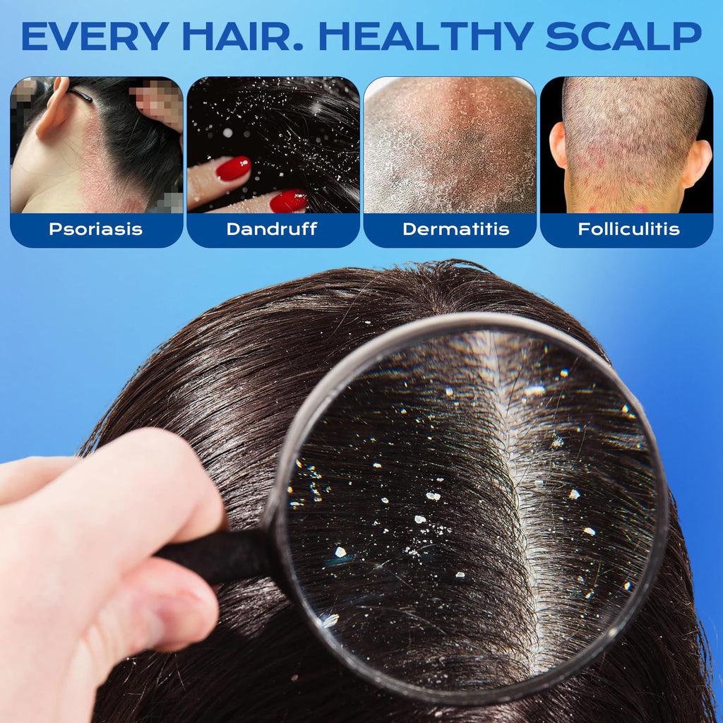 FYZMTL Anti-Dandruff Shampoo for Folliculitis & Scalp Psoriasis | Flake Control & Itch Relief