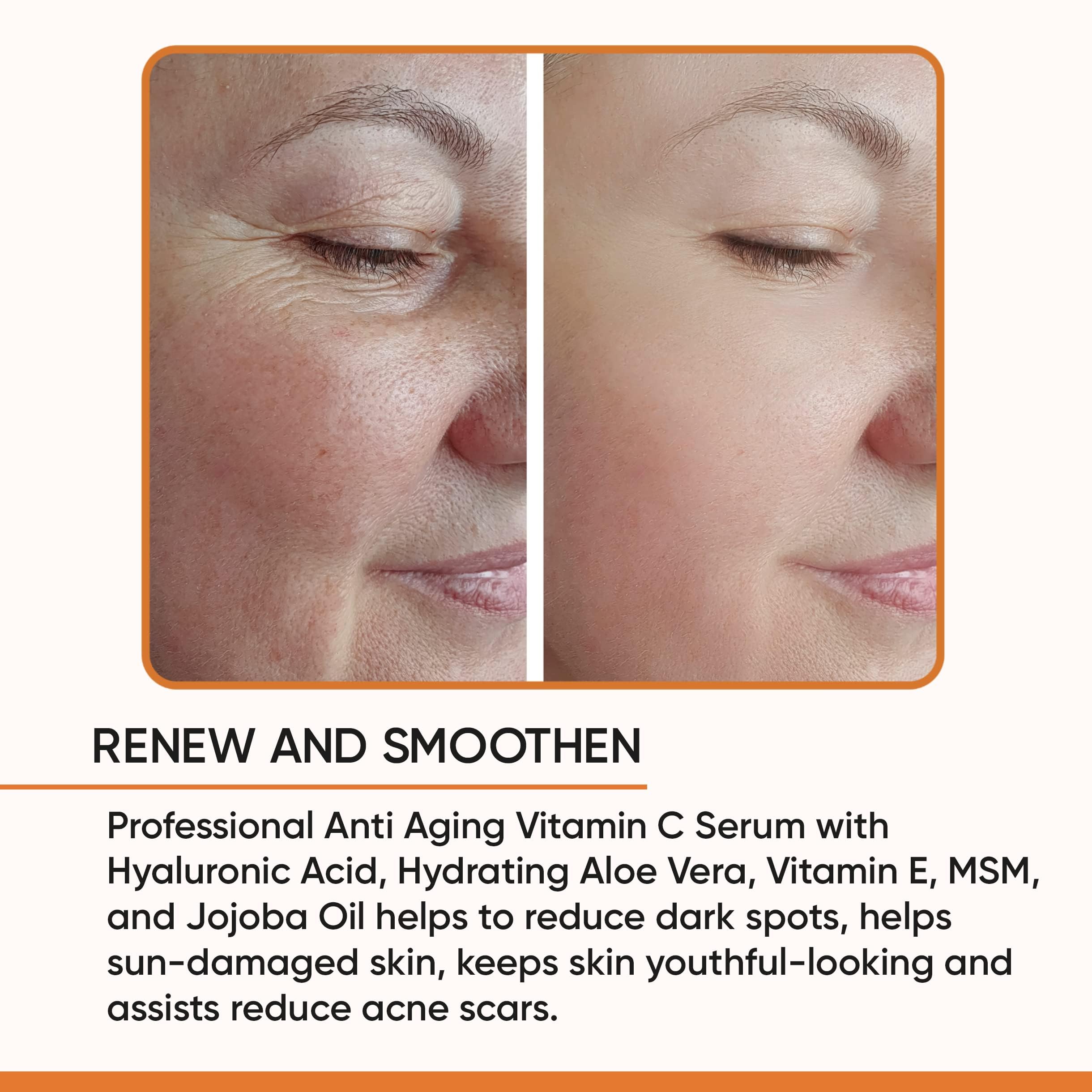 Gaudy Guru 100% Pure Vitamin C Serum for Face – Anti-Aging with Hyaluronic Acid