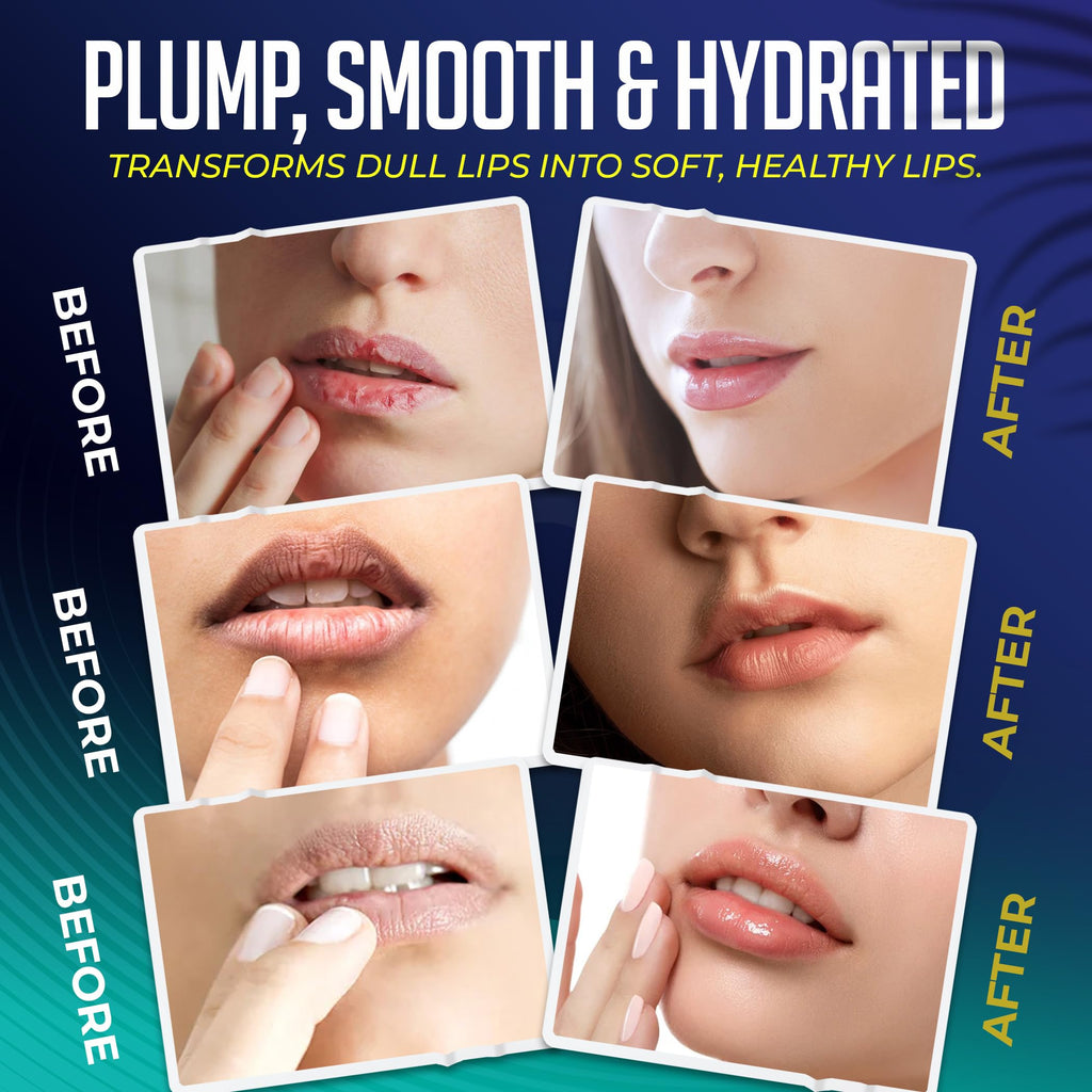 Generic 30-Pack Overnight Collagen Lip Mask – Hydrating Night Treatment