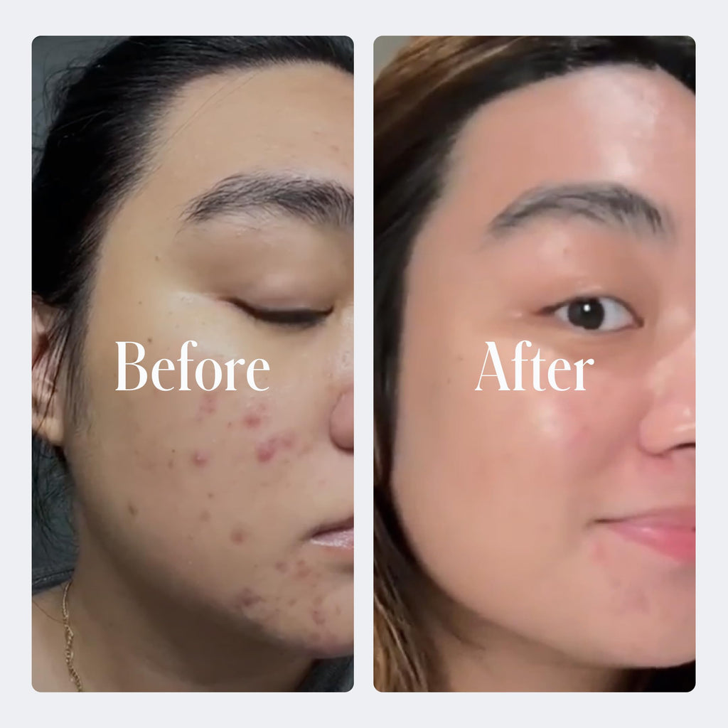Geologie Complete Skincare Set – 5-Piece Daily Routine for Clear Skin