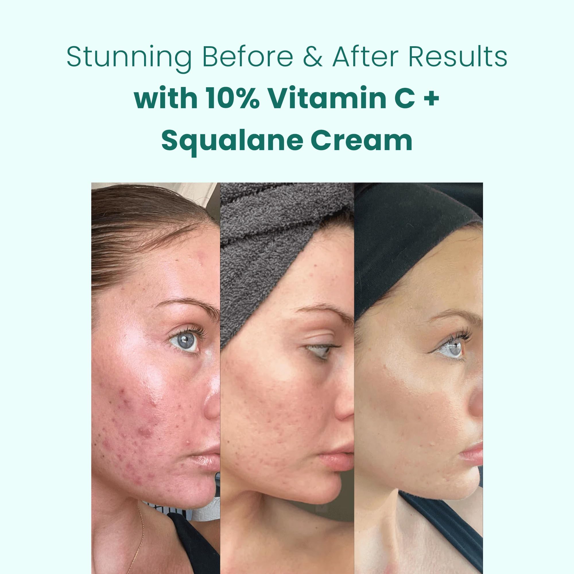 Gin Amber Beauty Vitamin C (10%) + Squalane Repair Cream – Face Moisturizer & Primer (1 fl oz)