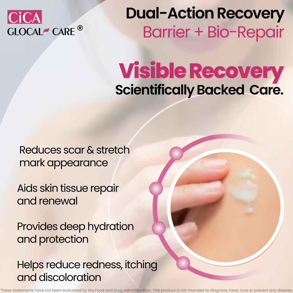 GlocalCare CICA Scar Cream – Silicone Scar Treatment for New & Old Scars, PIH & Stretch Marks (50 ml)