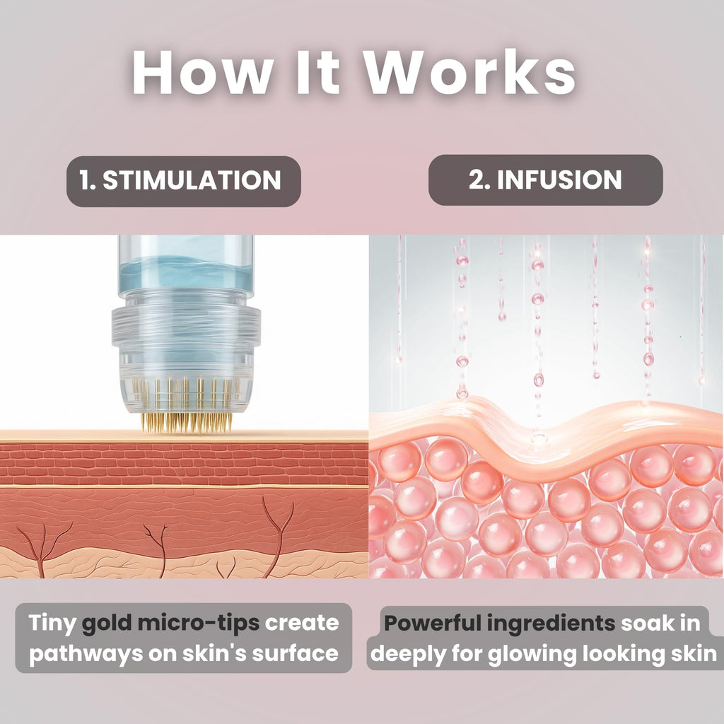 Glov Beauty Micro Infusion System – 0.25mm Gold Facial Stamp with Hyaluronic Serum (4 Infusions, 12 Ampoules)