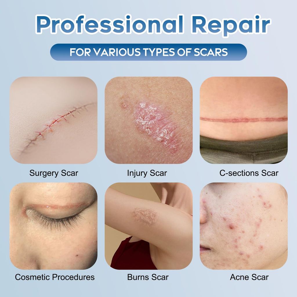 Glowor Advanced Silicone Scar Gel for Face & Body – Scar Cream for Old & New Scars