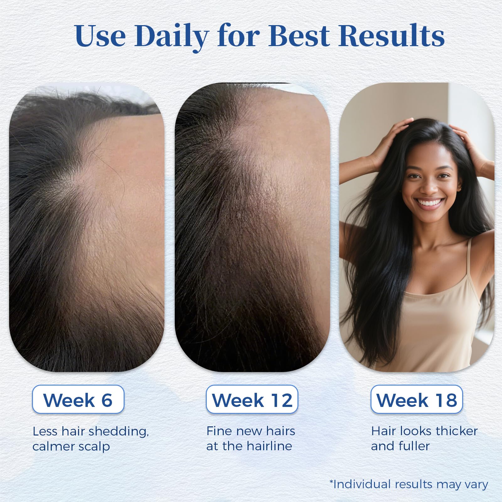 Gluvelessia Hair Growth Serum Roll-On with Rosemary – Thicker, Fuller-Looking Hair (Pack of 3)