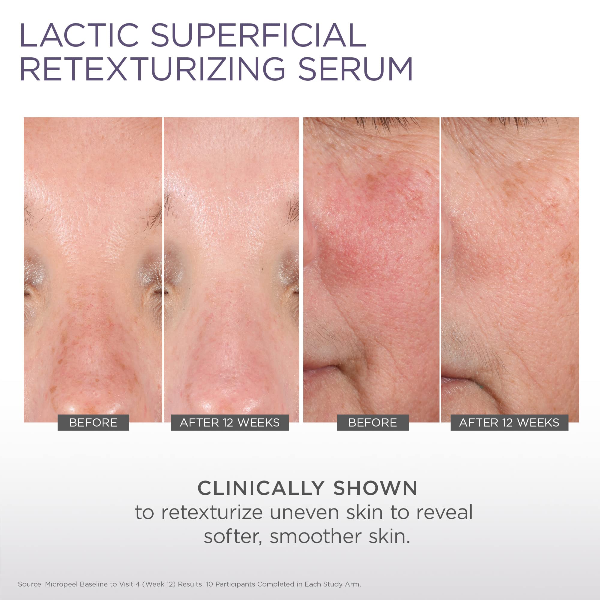 Glytone Micro-Peel Lactic Serum | 10% AHA Exfoliant for Face | Hydrates & Brightens