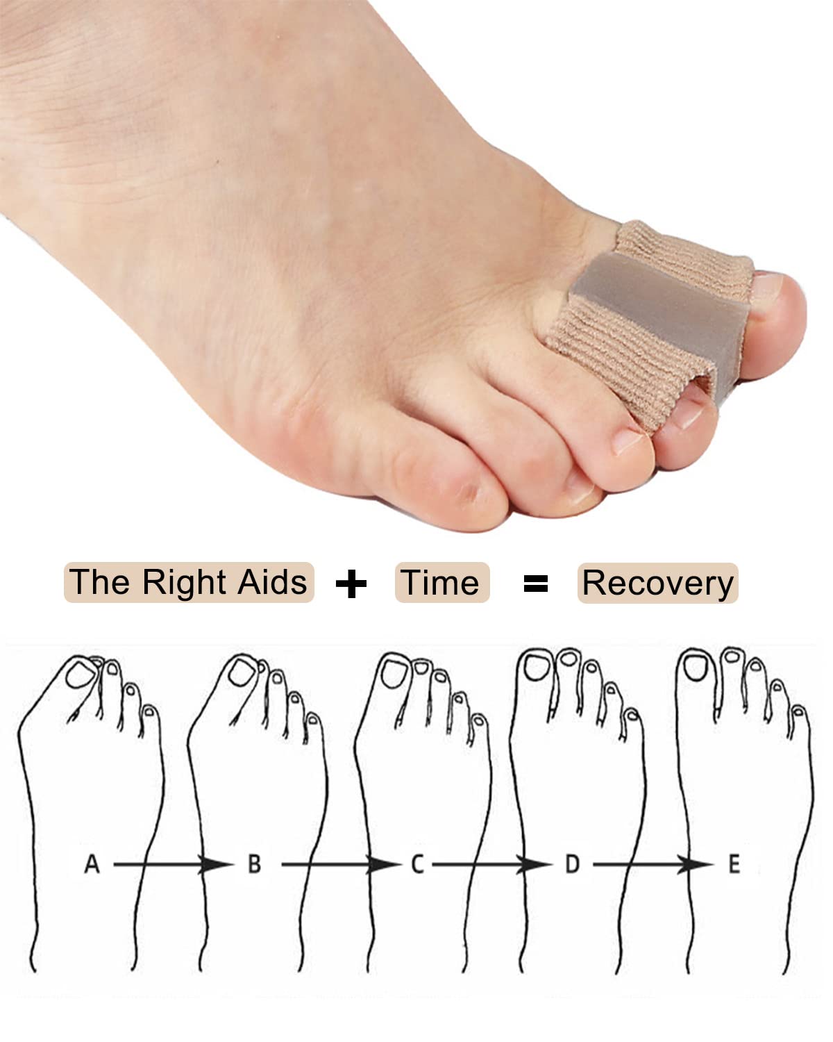 Golbylicc Bunion Toe Separators – Gel Toe Spacers for Overlapping Toes (4 Pack)