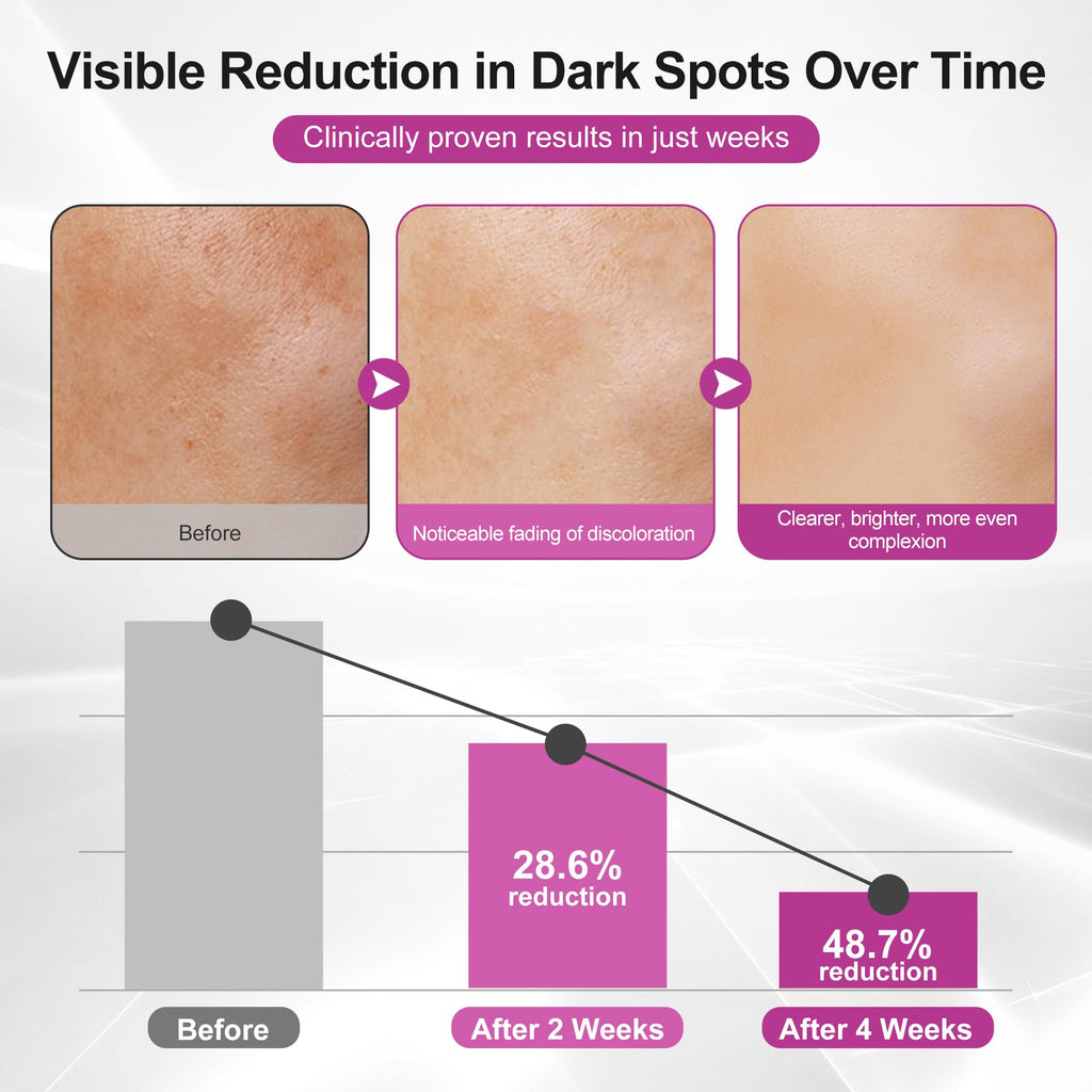 Goorly Dark Spot Remover Serum for Face & Body – Vitamin C, Niacinamide, Glutathione | 0.7 fl oz