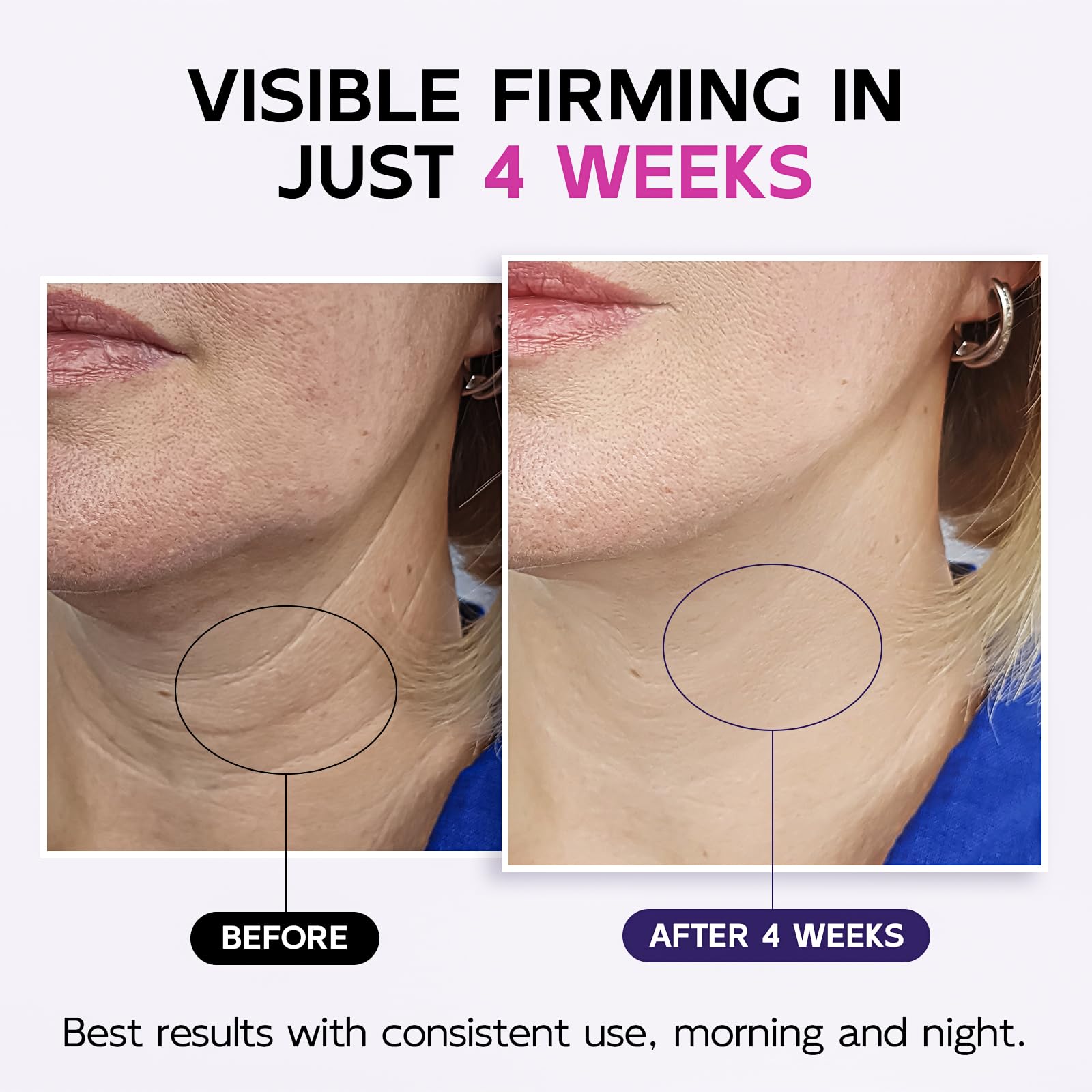 GOOSURE Neck Firming Cream with Roller – Multi-Peptide, Retinol & Hyaluronic Acid, 4.3 oz