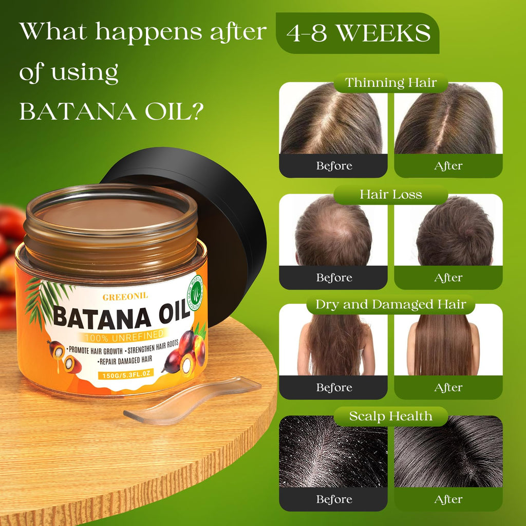 GREEONIL Batana Oil with Scalp Massager Brush for Hair Growth – 100% Pure & Organic