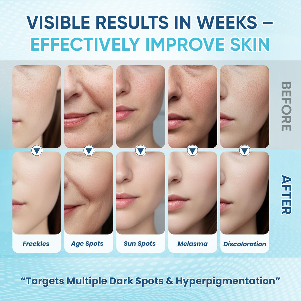 Greoay Dark Spot Remover Serum for Face & Body – Hyperpigmentation Treatment, Brighten & Even Skin Tone, 2 x 1 Fl Oz