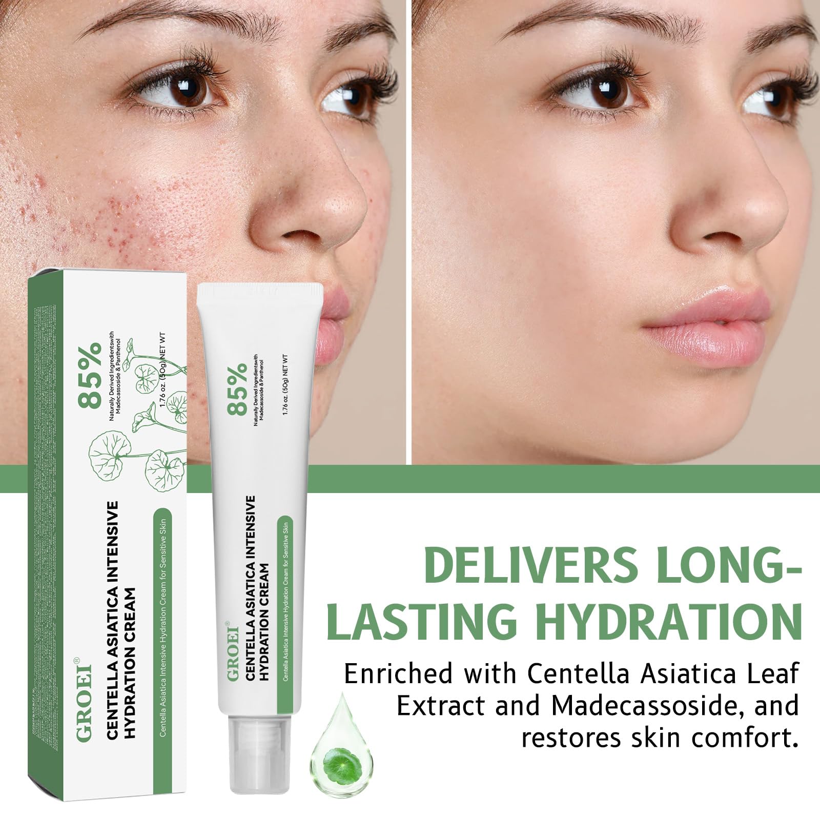 GROEI Centella Asiatica Intensive Hydration Cream - 85% Natural Ingredients | 50g