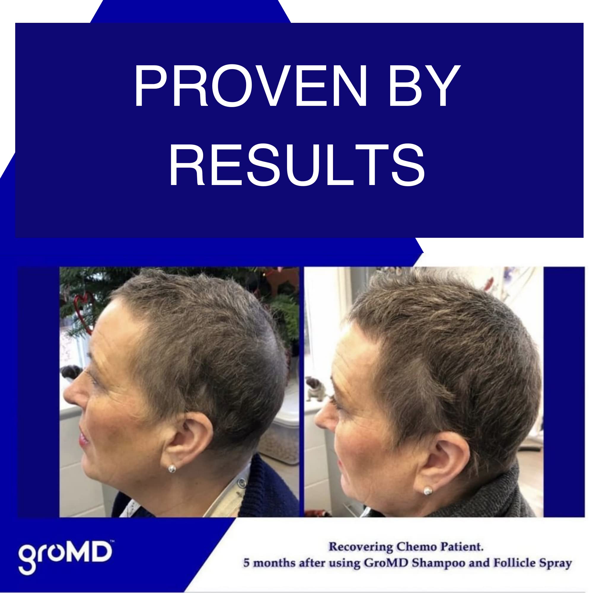 GroMD Biotin Shampoo & Conditioner – Hair Growth & Thickening