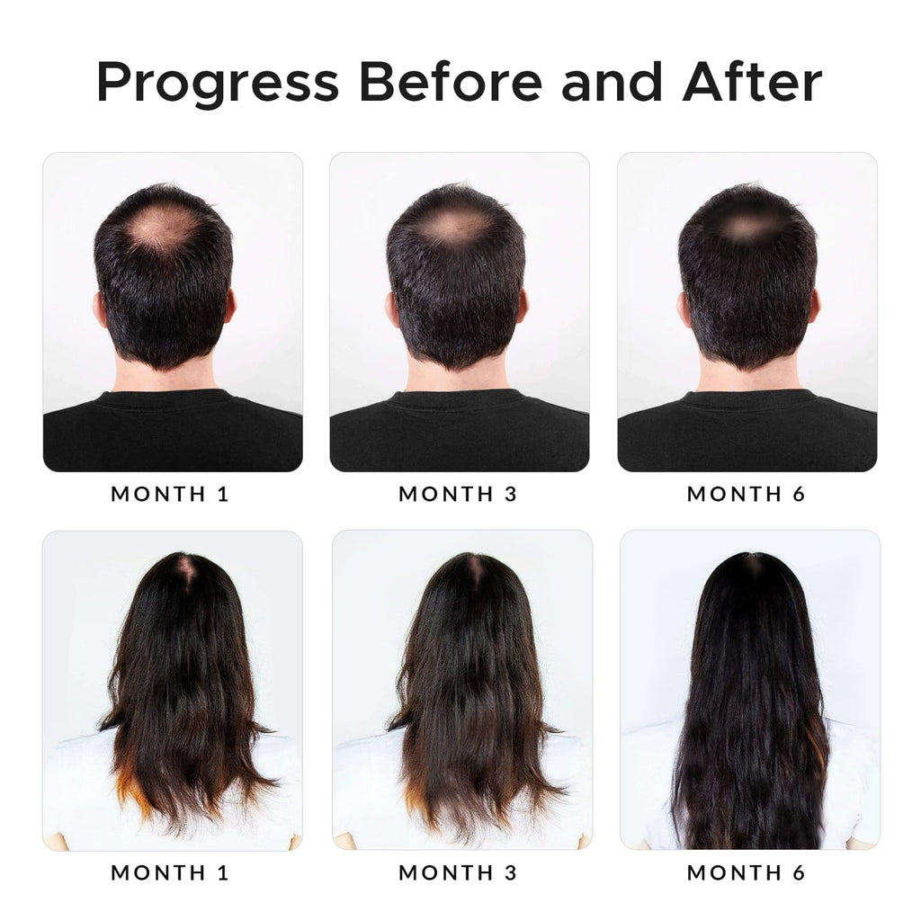 Growth Essence Minoxidil & Biotin Shampoo for Hair Growth – DHT Blocker & Nourishing Formula