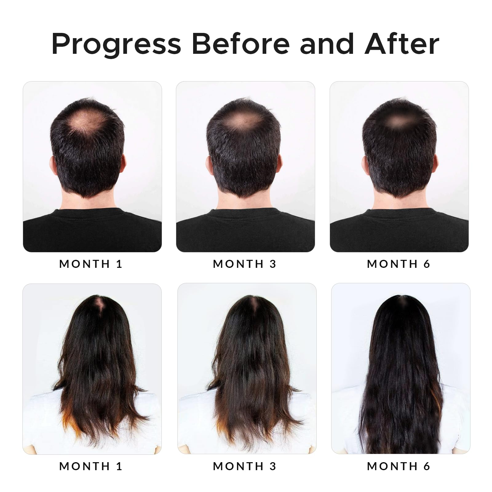 Growth Essence Twopack Thickening Hair Regrowth Shampoo – Minoxidil & Biotin