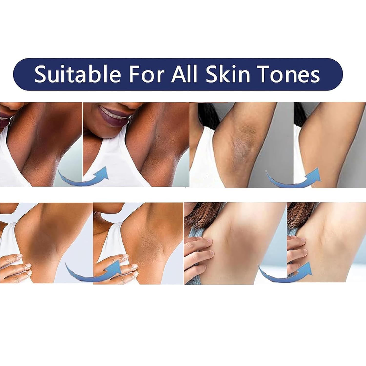 Gukei Skin Lightening Cream Gel for Private Parts & Underarms – Niacinamide, Arbutin, Vitamin C (30ML)