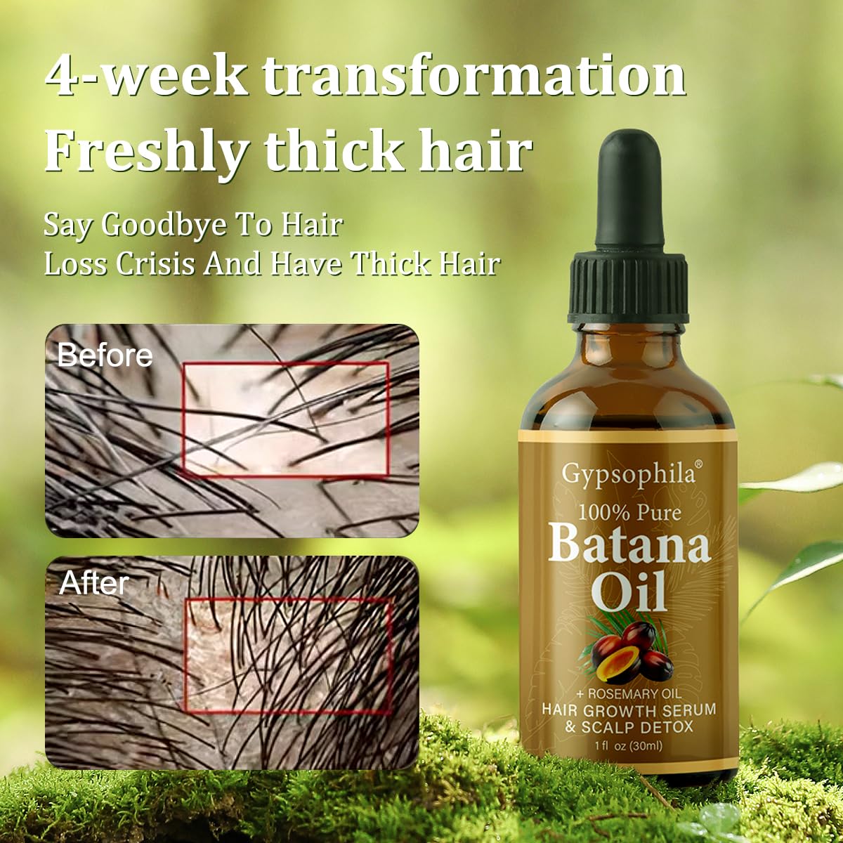 Gypsophila Batana Oil for Hair Growth – 100% Pure, Scalp Nourishment (2 Pack)