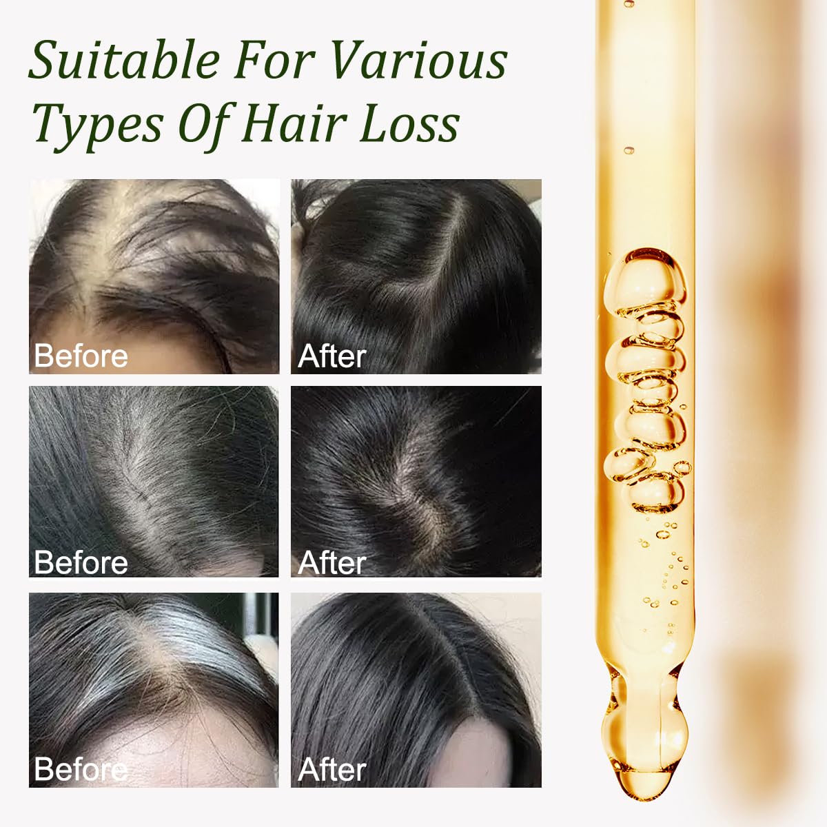 Gypsophila Batana Oil for Hair Growth – 100% Pure, Scalp Nourishment, Breakage Reduction (1 Fl Oz)