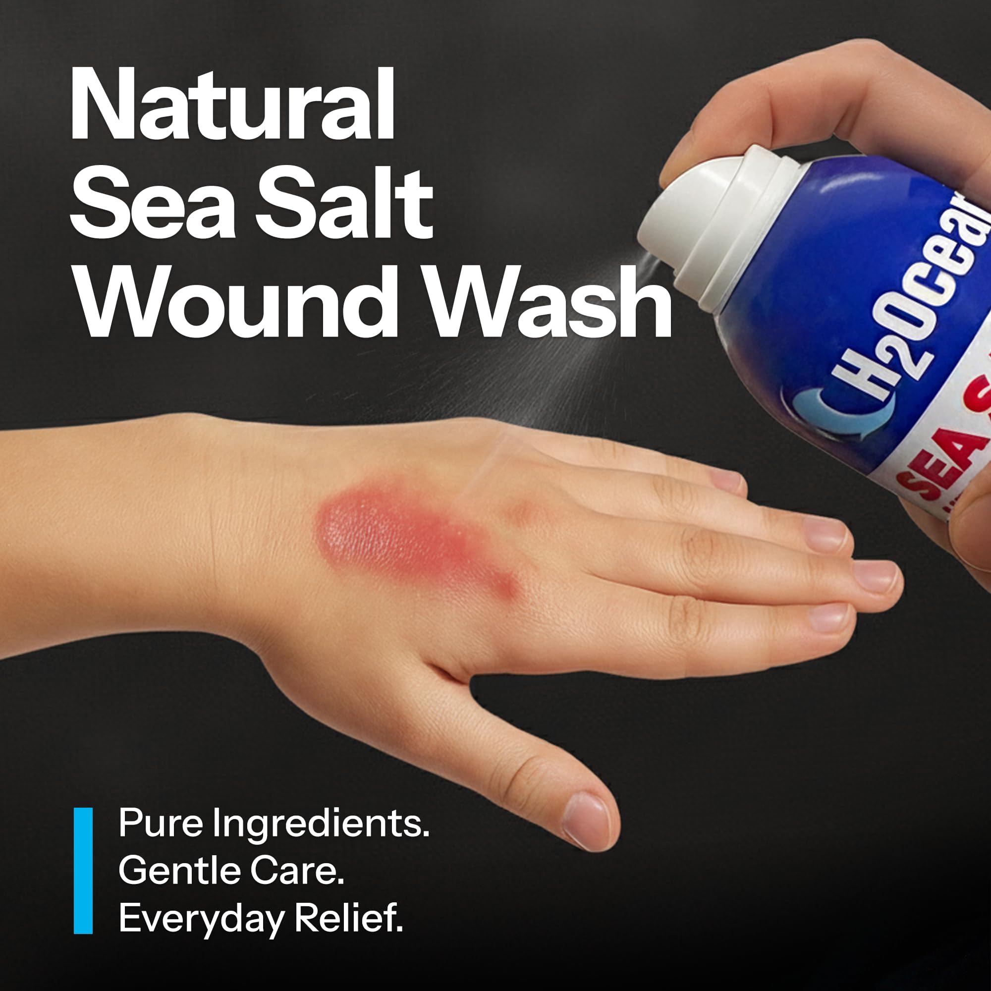 Healing Ocean Sea Salt Wound Spray – Natural Piercing & Wound Wash, Red Sea Salt & Lysozyme, 6oz