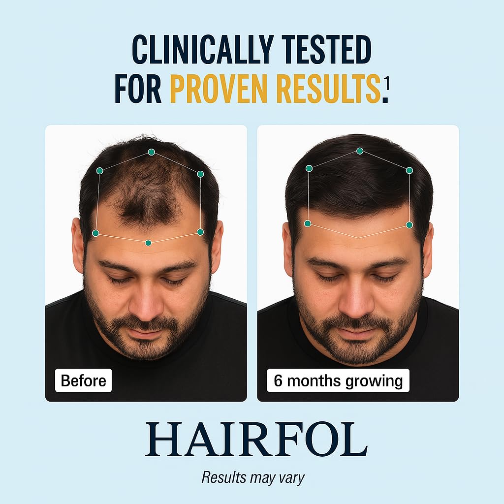 Hairfol Men's Hair Growth Supplement – Thicker Hair, Fuller Scalp Coverage – 1 Month Supply