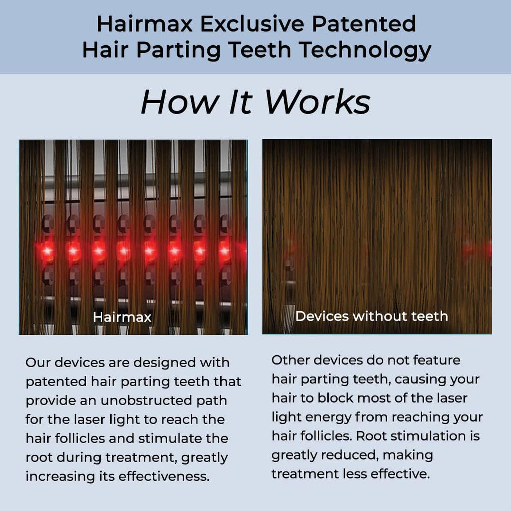HairMax Ultima 12 Classic LaserComb – FDA-Cleared Hair Growth Device for Men & Women